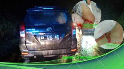 Revo Kontra Avanza Dijalan Siantar-Parapat, Daniel Panjaitan Warga Labuhan Batu Alami Luka-luka