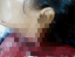 Seorang Wanita Ganguan Jiwa Tega Menggorok Lehernya